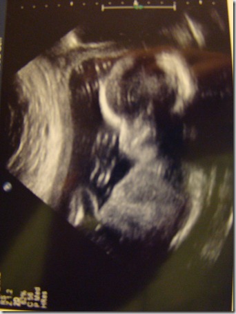 baby4 108