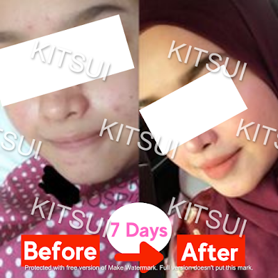 kitsui supplement product, testimonial and review