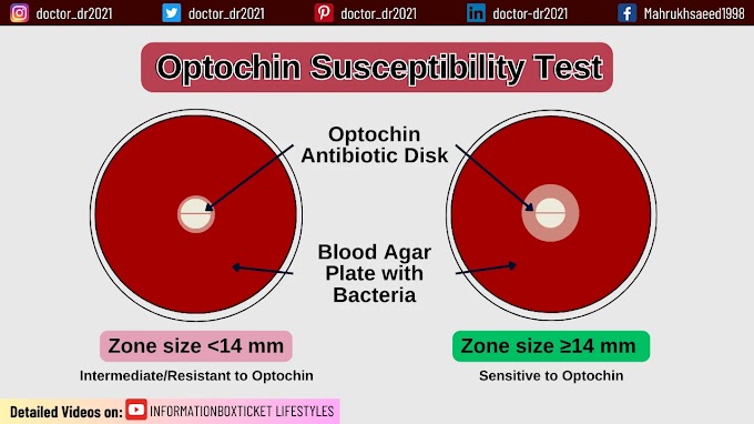 Optochin Susceptibility Test - Principle, Procedure, Results