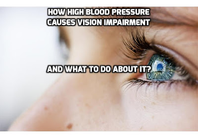 A research team from Saitama Medical University in Japan, knowing that high blood pressure caused vision impairment, wanted to analyze the relationship between color vision, eye disease, heart attack risk, and lifestyle habits. Read on to find out more.