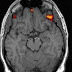 Il cervello e' pieno e non si evolverà più