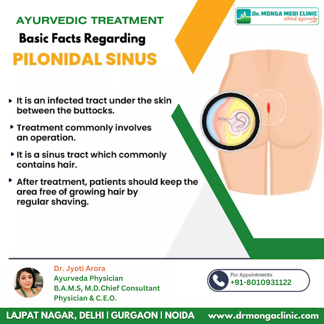 Pilonidal Sinus Treatment Near Rajouri Garden