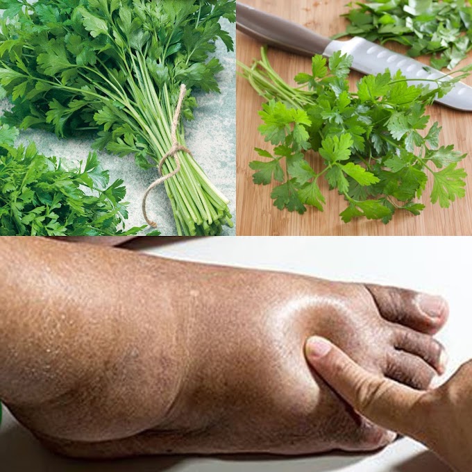 A Natural Way to Lessen Water Retention with Parsley