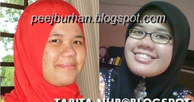 Tabita Skincare @ Tabita-nhb: Testimonial - Najwa