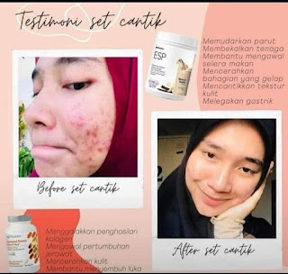 Testimoni Set Kulit Cantik Shaklee