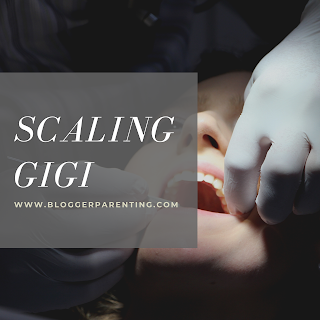 Scaling Gigi