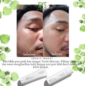 Produk Skincare Untuk Mengecilkan Liang Pori Kulit Muka Besar