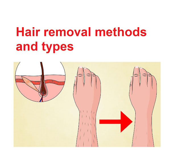 Hair removal methods and types