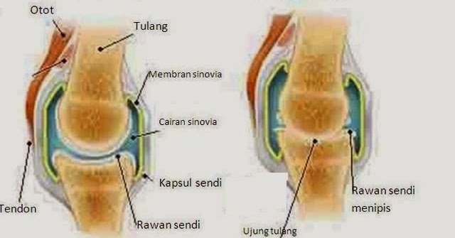 Cecair Sendi Susut - Gel Lutut