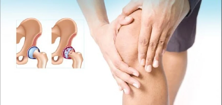 joint pain, arthritis, joints, arthritis treatment, pain, joint treatment, joint pain, joint pain, joint pain treatment, forget about joint pain, paint for joint pain, rheumatoid arthritis, joint pain and exercise, joint and muscle pain, knee and joint pain Symptoms of arthritis, goodbye to the agony of joint pain, joints, love of Rashad for joint pain, herbal arthritis treatment, benefits of turmeric for joint pain, for joints, hand joints, body joint pain, causes of sudden joint pain