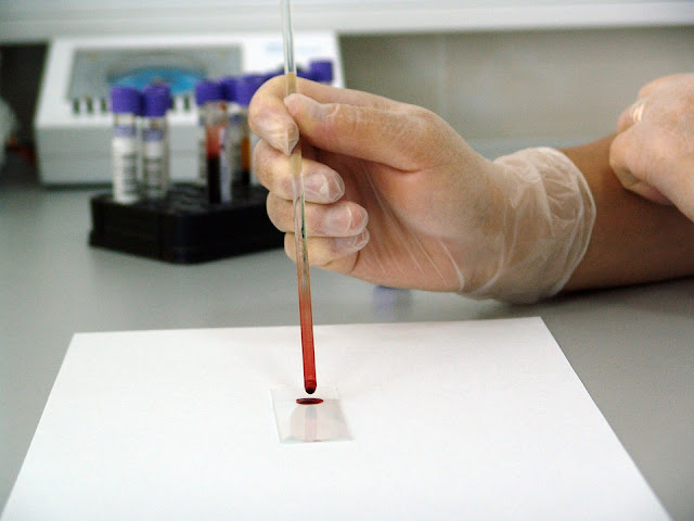 prueba-sangre-laboratorio-cancer