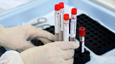 Українці зможуть безкоштовно здавати тести на COVID-19 у приватних лабораторіях – рішення уряду