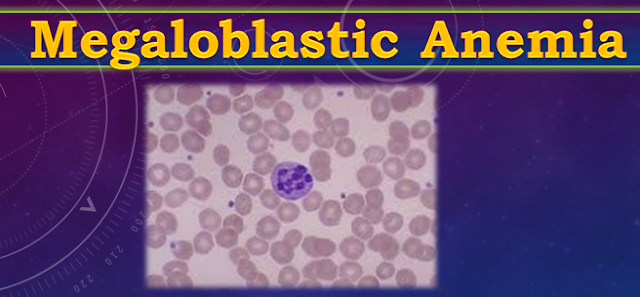 Megaloblastic Anemia