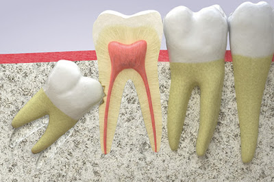 Răng khôn hàm trên có mấy chân? Khi mọc có đau không? 1
