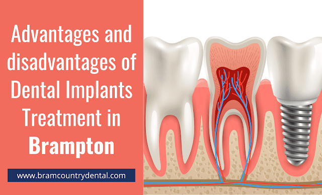 dental-Implants-advantages-and-disadvantages