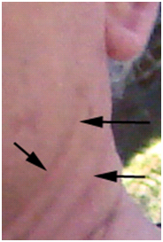 Heal Brush Example Area