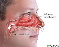 kesehatan tetang lubang hidung