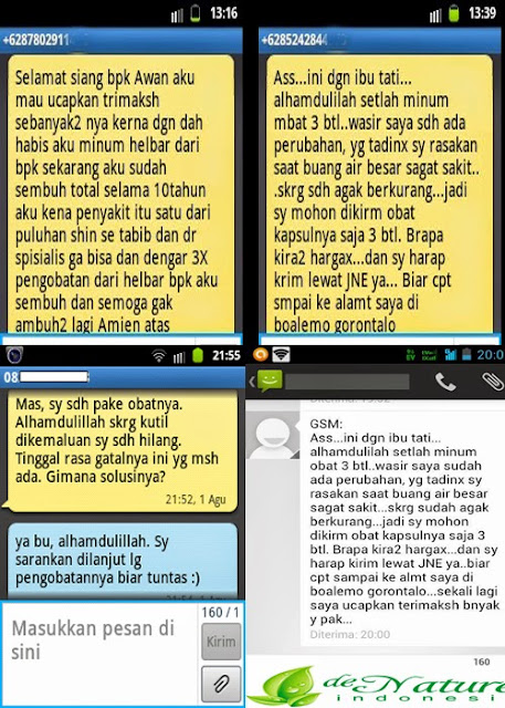 Testimoni Wasir