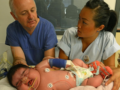Les 500+ meilleures plus gros bébé à la naissance 137083-Les plus gros bebe a la naissance