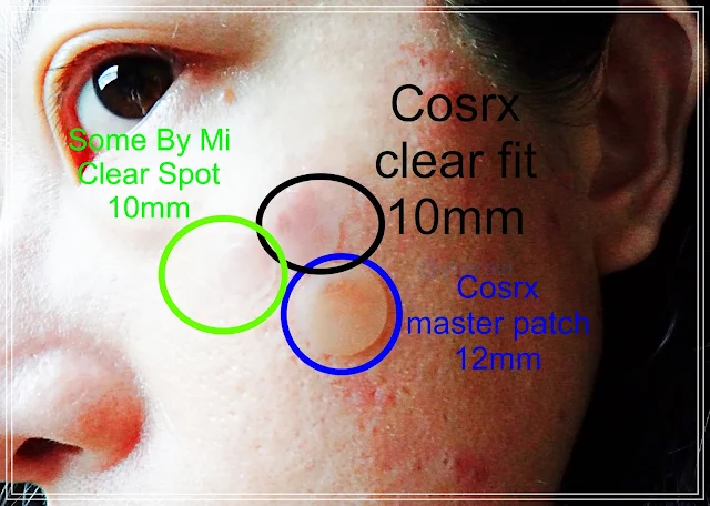 Some By Mi 30 Days Miracle Clear Spot Patch VS Cosrx Clear Fit VS Cosrx Master