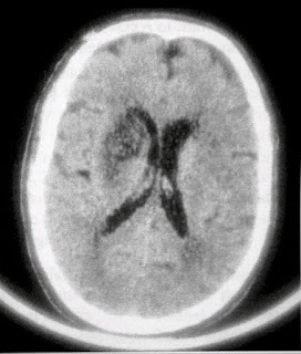 Head CT- Top 5 solved common cases