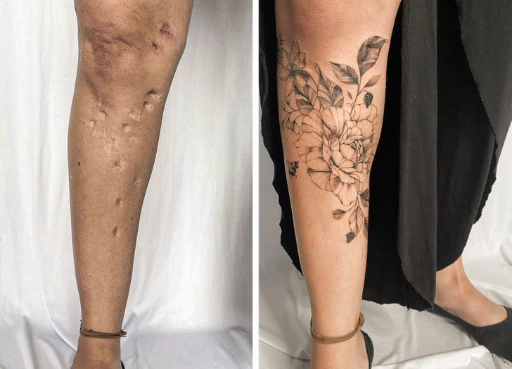 permanent scar cover up