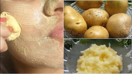 5 Potato Face Packs For Beautiful Skin