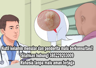 Obat Kutil Kelamin