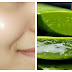 How To Get Clear, Glowing, Spotless Skin By Using Aloe Vera Gel