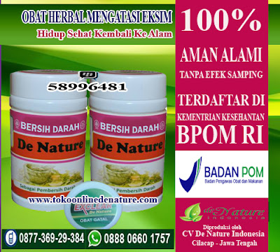 OBAT HERBAL MENGATASI EKSIM