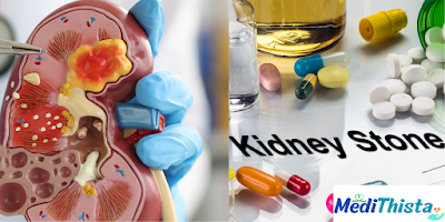 Causes Of Kidney Pain