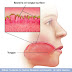 Halitosis-mulut berbau