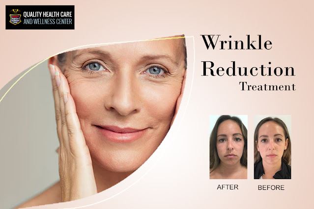 Wrinkle reduction treatment New Jersey