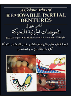 http://asnan-doctors.blogspot.com/2016/06/removable-partialdentures-ar.html