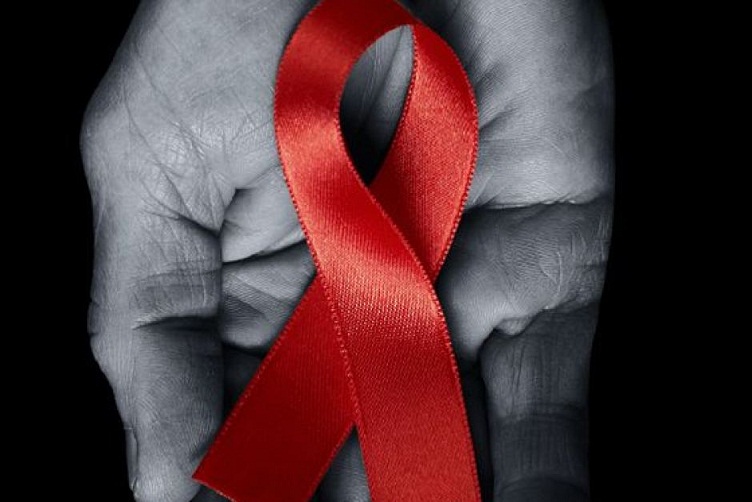  Teori Kera Hijau dan Asal Usul HIV/AIDS yang Misterius