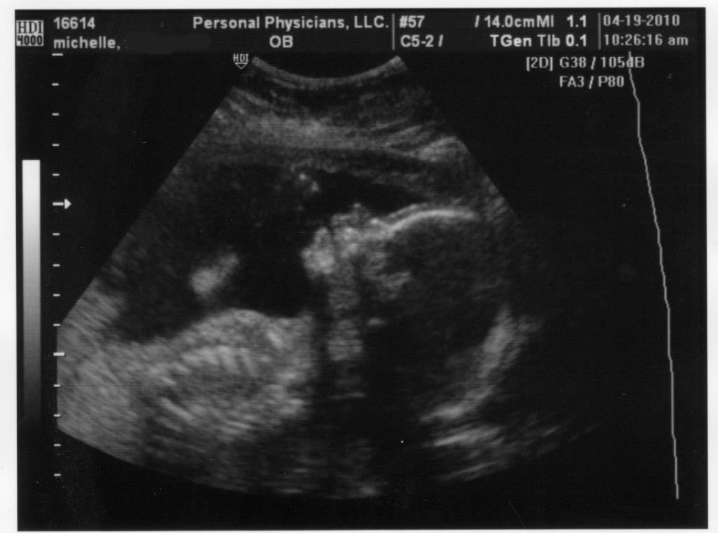 In Our Own World Pregnancy Week 24 Belly Pics Of Baby Boy In Our Own World Pregnancy Week 24 Belly Pics Of Baby Boy
