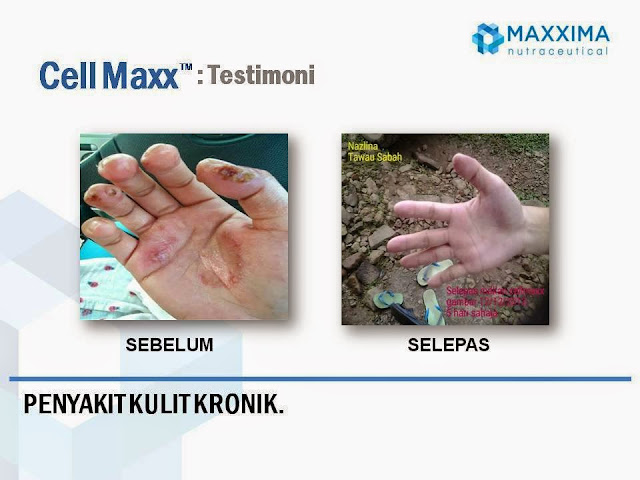 Jual CellMaxx di Probolinggo