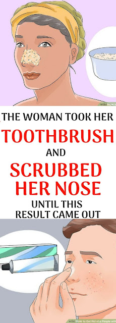 The Women Took Her Toothbrush And Scrubbed Her Nose Until This Result Came Out !