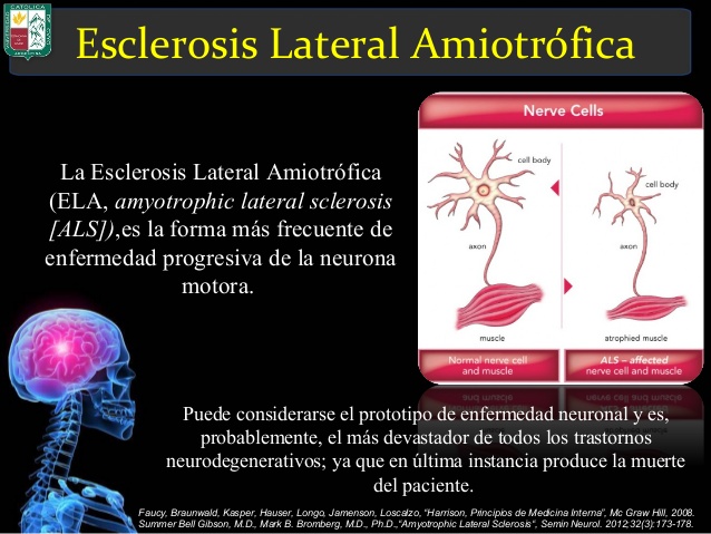 Horacio Fritzler, experiencias ELAsticas y otras : GLOSARIO DE PALABRAS Y ACCIONES DE LA ELA