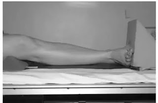 Tibia fibula xray