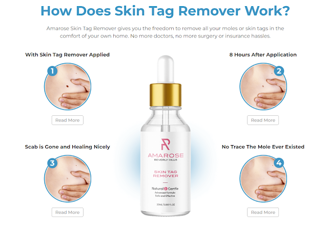 amarose-skin-tag-remover-working