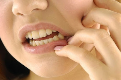 Bagaimana Cara Mengobati Sakit Gigi yang Ampuh