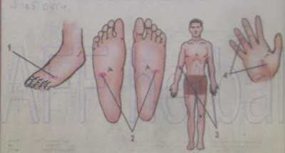 pijat refleksi untukk mengobati kurang darah