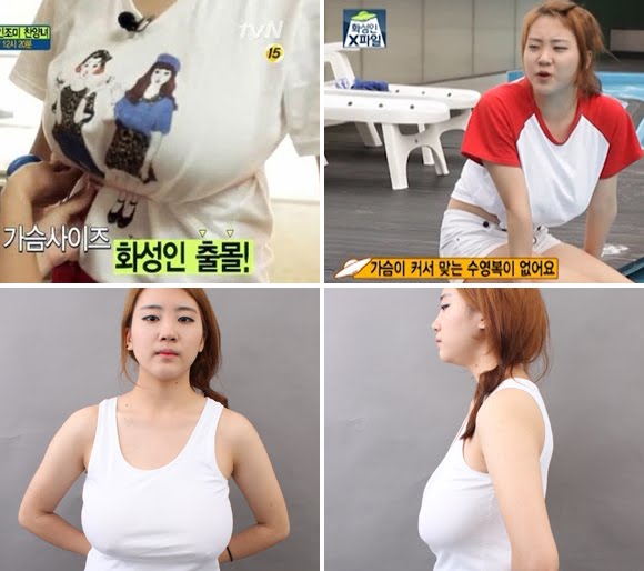 짱이뻐! - The Best Breast Surgery Saved Me From Pain