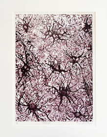 Astrocytes by Rosemary Feit Covey