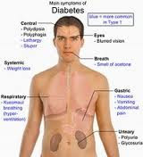 Faktor Resiko Diabetes Melitus (DM), Blog Keperawatan