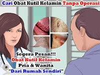 Obat Tradisional Untuk Kutil Kelamin Atau Kutil Di Kemaluan Atau Kutil Kelamin Atau Kutil Di Kemaluan