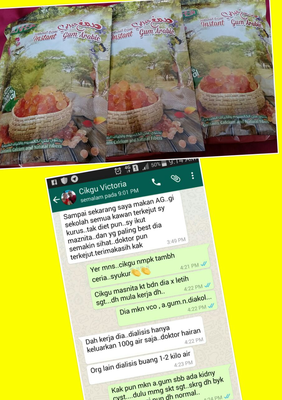 Rawatan Herba Dan Pemakanan: Testimoni Al manna / arabic gum