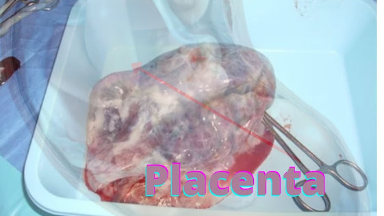 placenta images