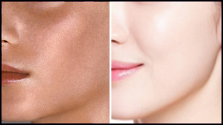 Skin Whitening Remedies At Home